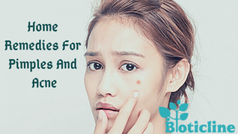 home remedies for pimples and acne